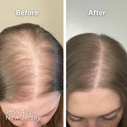 Ollea Red Light Therapy Brush