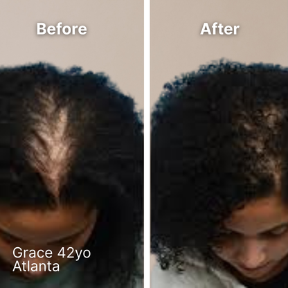 Ollea Red Light Therapy Brush