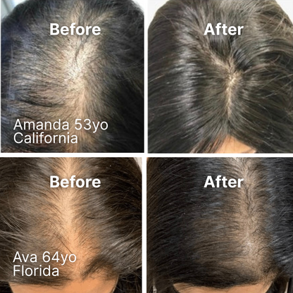 Ollea Red Light Therapy Brush